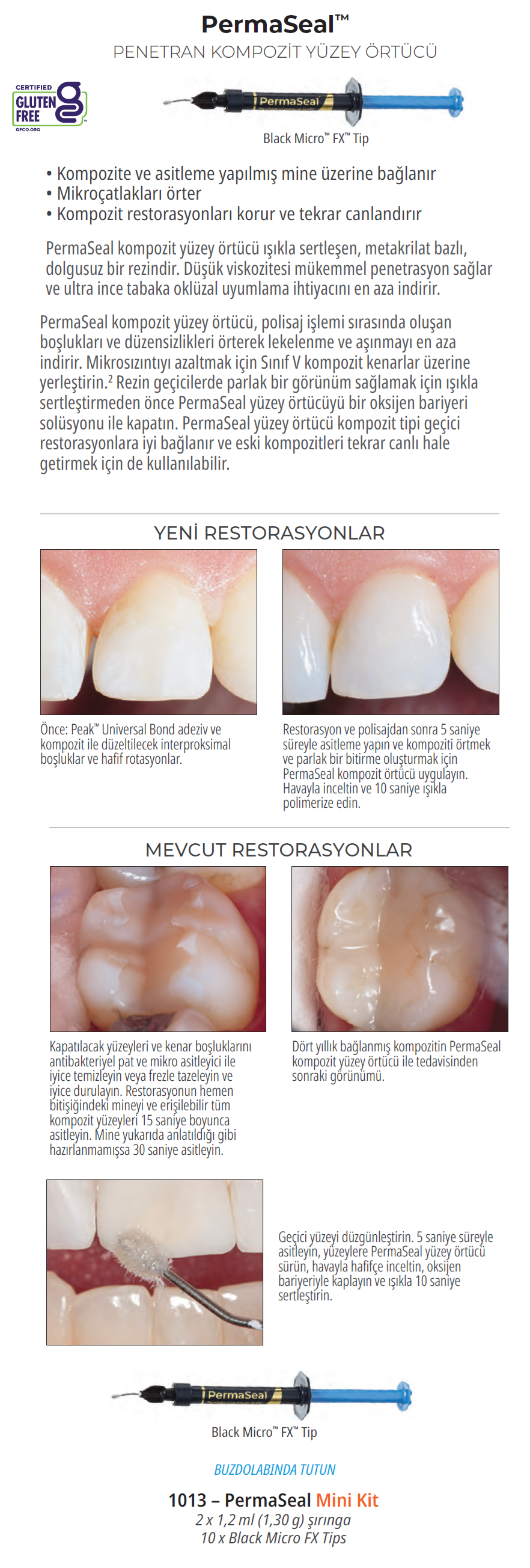 Ultradent Permaseal